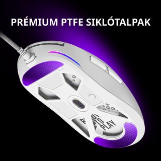 LORGAR MSA10 Vezetékes Gamer Egér - Fekete